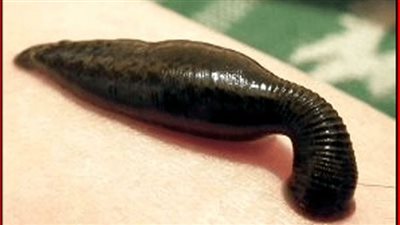 علماء يكتشفون لغز الأسنان النحاسية لديدان الدم