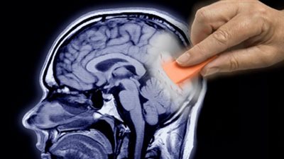 5 طرق فعالة لتحسين الذاكرة