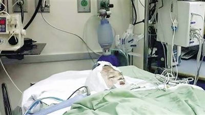 ضحايا الحروق يطالبون بالدعم.. وينبذون التنمر