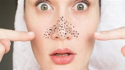 قبل عيد الفطر.. تخلصي من الرؤوس السوداء بـ 2 جنيه (تفاصيل)