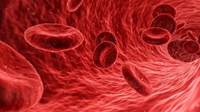 لماذا تنظيف الأوعية الدموية غير فعال؟