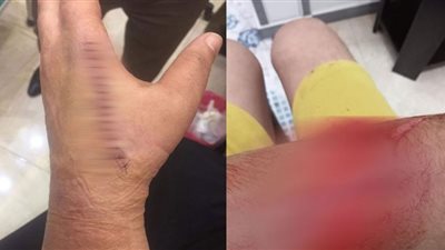 بلطجى يعتدى على سيدة أمام أطفالها ويمزق أجسادهما بالسلاح الأبيض فى دمياط