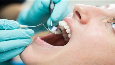 ما هو سرطان الفم وأشهر أعراضه