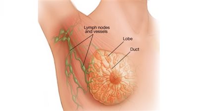 سلوكيات صحية تقلل خطر الإصابة بسرطان الثدي