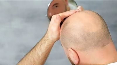 هذه الفئة من الرجال الأكثر عُرضة للوفاة بكورونا