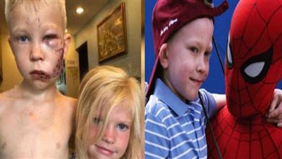 بلافتة إنسانية.. سبايدر مان يستضيف طفلاً دافع عن أخته من هجوم الكلب (صور وفيديو)