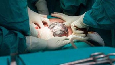 حجز طبيبة نساء وتوليد شهيرة بحلوان.. اعرف السبب