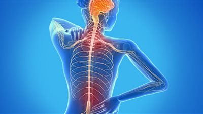 أهم المعلومات عن مرض التصلب المتعدد وأعراضه.. تعرف عليها
