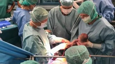 طبيب يقوم بعملية مليئة بالمخاطر لزراعة رحم في النساء المتحولات