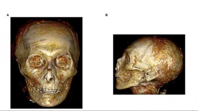 (شاهد) كيفية استخدام التصوير المقطعي في فك غلاف مومياء أمنحتب الأول