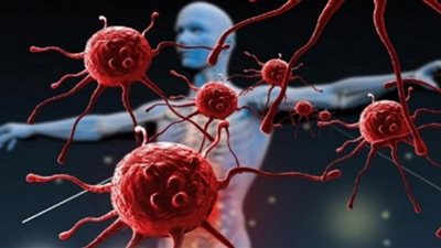 نوع من الخضراوات يساعد تناوله في عدم الإصابة بالسرطان