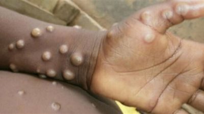 تعرف على خطورة 