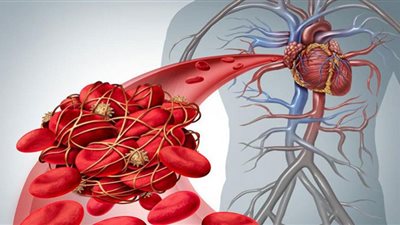 علماء يبتكرون روبوتا لعلاج تجلط الدم