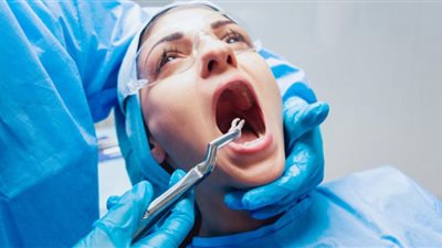 طب الأسنان يكشف أسباب تأخر ظهور ضرس العقل في الفم