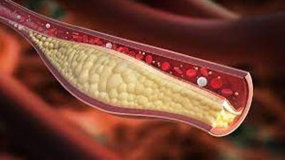 دراسة: ألواح الطاقة تسبب ارتفاع مستويات الكوليسترول