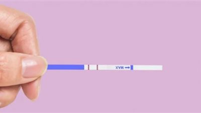 سريع وغير مكلف.. اختبار جديد يكشف سرطان البروستاتا