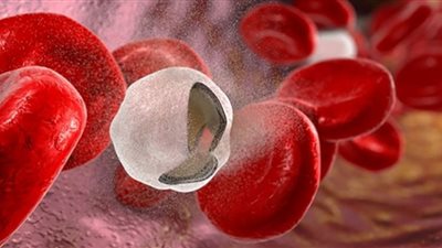 تعرف على مرض أنيميا الفول والأكلات الممنوعة عنه وكيف ينتقل