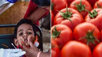 التفاصيل الكاملة| العالم يُواجه أنفلونزا جديدة تُشبه الطماطم على الجلد