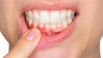 3 علاجات منزلية لآلام اللثة تخلصك من الألم خلال دقائق
