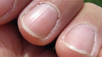 سبب ظهور الـ 