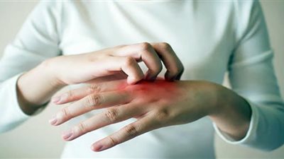 3 علامات على الجلد تؤكد إصابتك بمتحور أوميكرون.. خبراء الصحة يحذرون