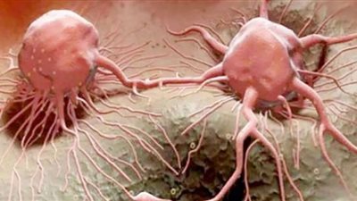 أعراض مزعجة للسرطان تجعلك مستيقظًا طوال الليل