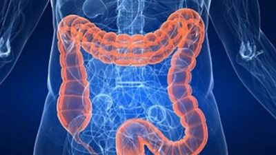 انتبه لها.. طبيبة روسية تكشف أولى الأعراض المبكرة لسرطان الأمعاء