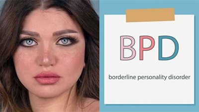 بعد إعلان ياسمين الخطيب محاولة الانتحار بسببه| ما هو الـ BPD أسبابه وأشهر أعراضه