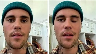 جاستن بيبر يُعلن إصابته بمتلازمة نادرة سببت شلل في الوجه (فيديو)