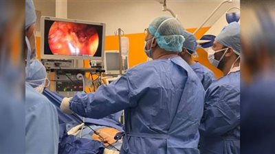 نجاح جراحة ويبل بالمنظار الجراحي بمركز أورام بالبحيرة