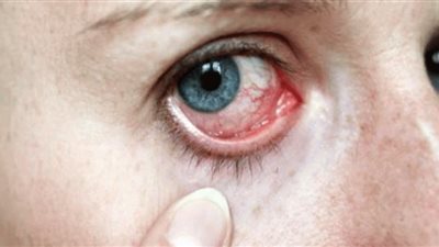 دراسة: شبكية العين تتنبأ بالنوبة القلبية قبل عام بنسبة 80%