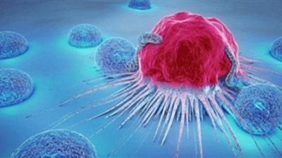 باحثان مصريان ينجحان في اكتشاف الجينوم الوراثي الخاص بسرطان المثانة| ما القصة