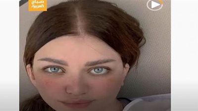 (فيديو) مشاهير حول العالم أصيبوا بأمراض غير اعتيادية