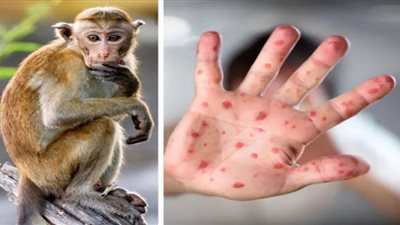 مفاجأة.. علماء يطورون اختبار 