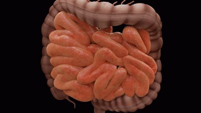 علامات بسيطة تدل على الإصابة بـ سرطان الأمعاء