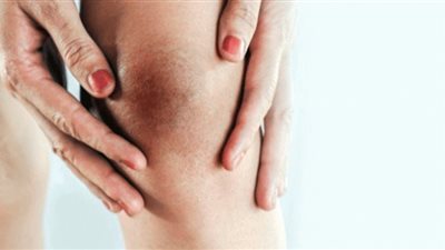 علاج إسمرار الجلد بمناطق السجود (تفاصيل)