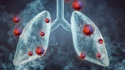 خبيرة: فيروس كورونا فقد قدرته على اختراق أنسجة الرئتين