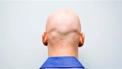 توليد الكهرباء من رأس الإنسان.. الصلع طريق جديد للثراء
