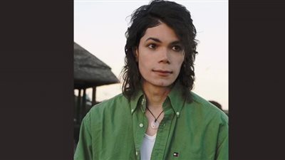 صور .. شبيه مايكل جاكسون يثير الجدل على السوشيال .. ويؤكد: لم أخضع لجراحة