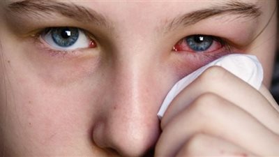 دراسة صادمة: أمراض العيون تُزيد فرص الإصابة بمرض لا علاج له