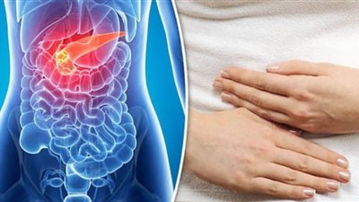 3 أعراض هامة لسرطان البنكرياس