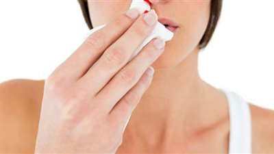 طبيبة روسية تحدد سببين لحدوث نزيف الأنف في فصل الشتاء