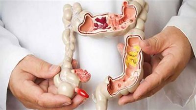 4 أنواع ألم دليل إصابتك بورم في الأمعاء