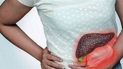 انتفاخ الساقين تدل على إصابتك بـ مرض الكبد الدهني