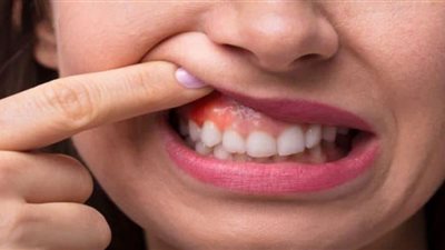 دراسة تكشف العلاقة بين أمراض اللثة وضعف وظائف الرئة