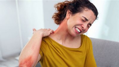 لماذا يظهر الطفح الجلدي عند الإصابة بمتحور أوميكرون؟.. طبيبة تكشف السر