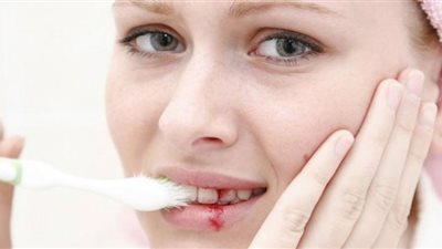منها الحَمل.. 6 أسباب غير متوقعة وراء نزيف اللثة| طرق علاجها