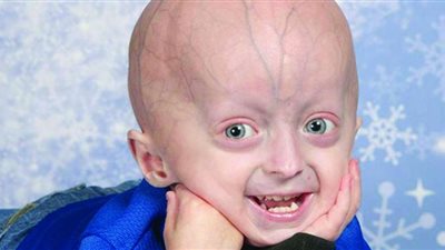 نصائح للحفاظ على نضارة البشرة وحمايتها من الشيخوخة المبكرة