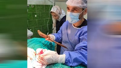 مستشفى الدلنجات تنجح في إنقاذ حياة مواطن بعد إصابته بسلاح أبيض