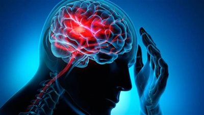 ما عواقب الإصابة بالجلطة الدماغية؟